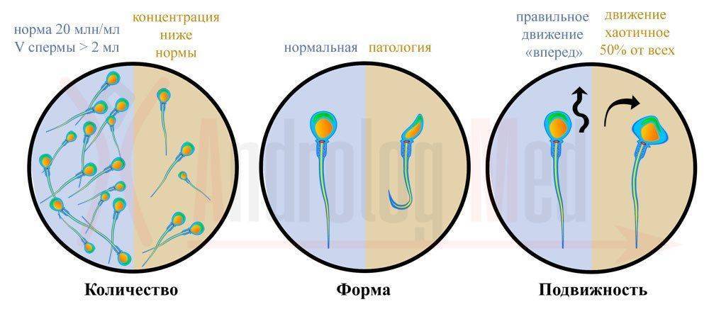 Что может показать спермограмма