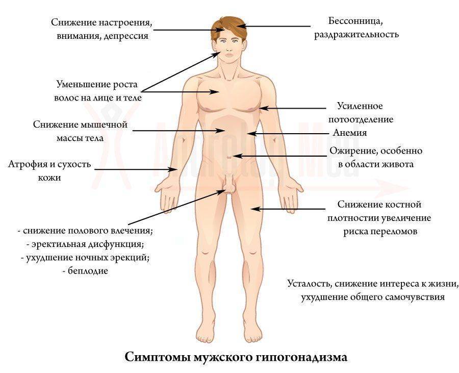 Основные симптомы мужского гипогонадизма