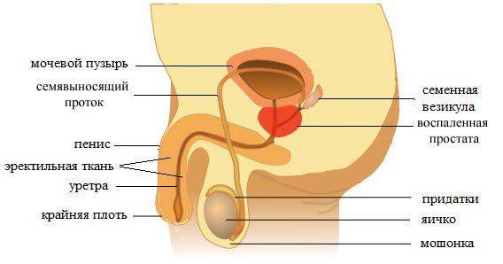 Признак простатита — воспаленная простата