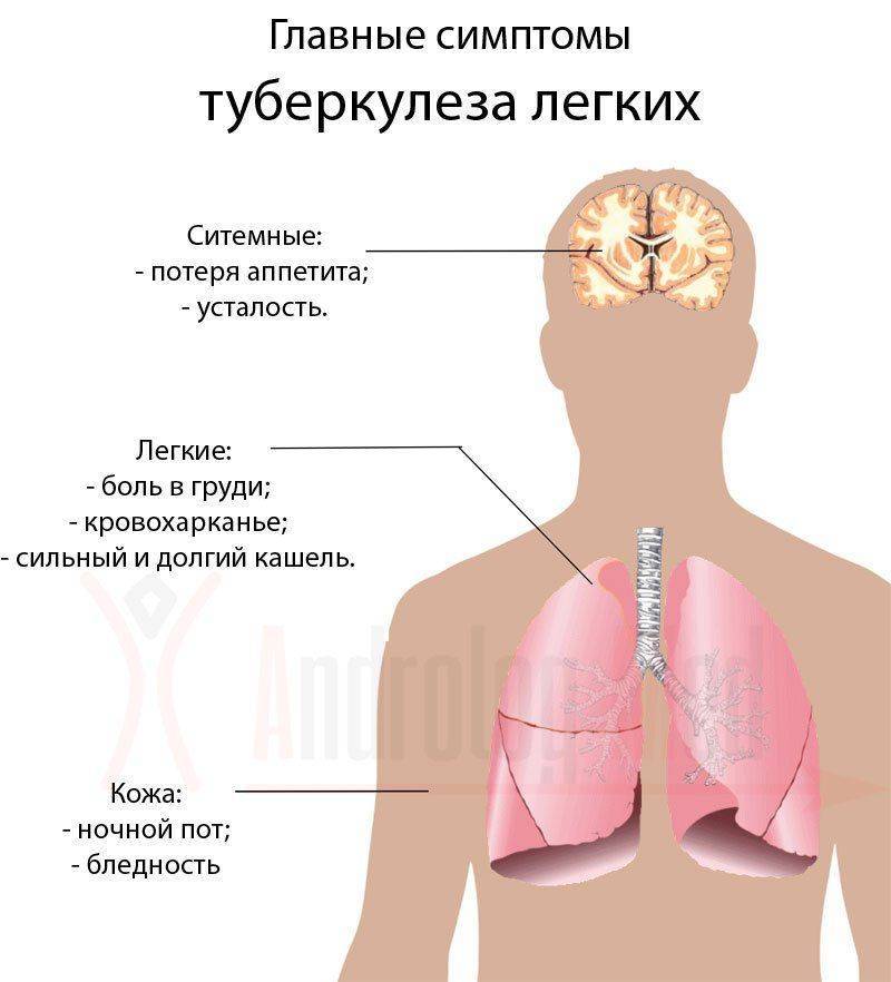 Главные симптомы туберкулеза легких