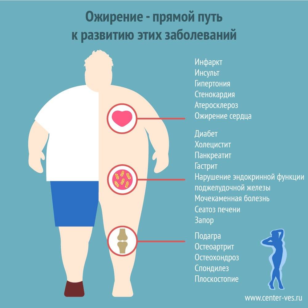 Очевидные Причины Лишнего Веса