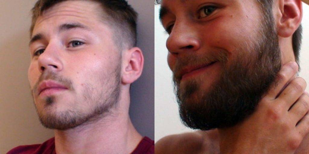 Что сделать, чтобы росла борода?