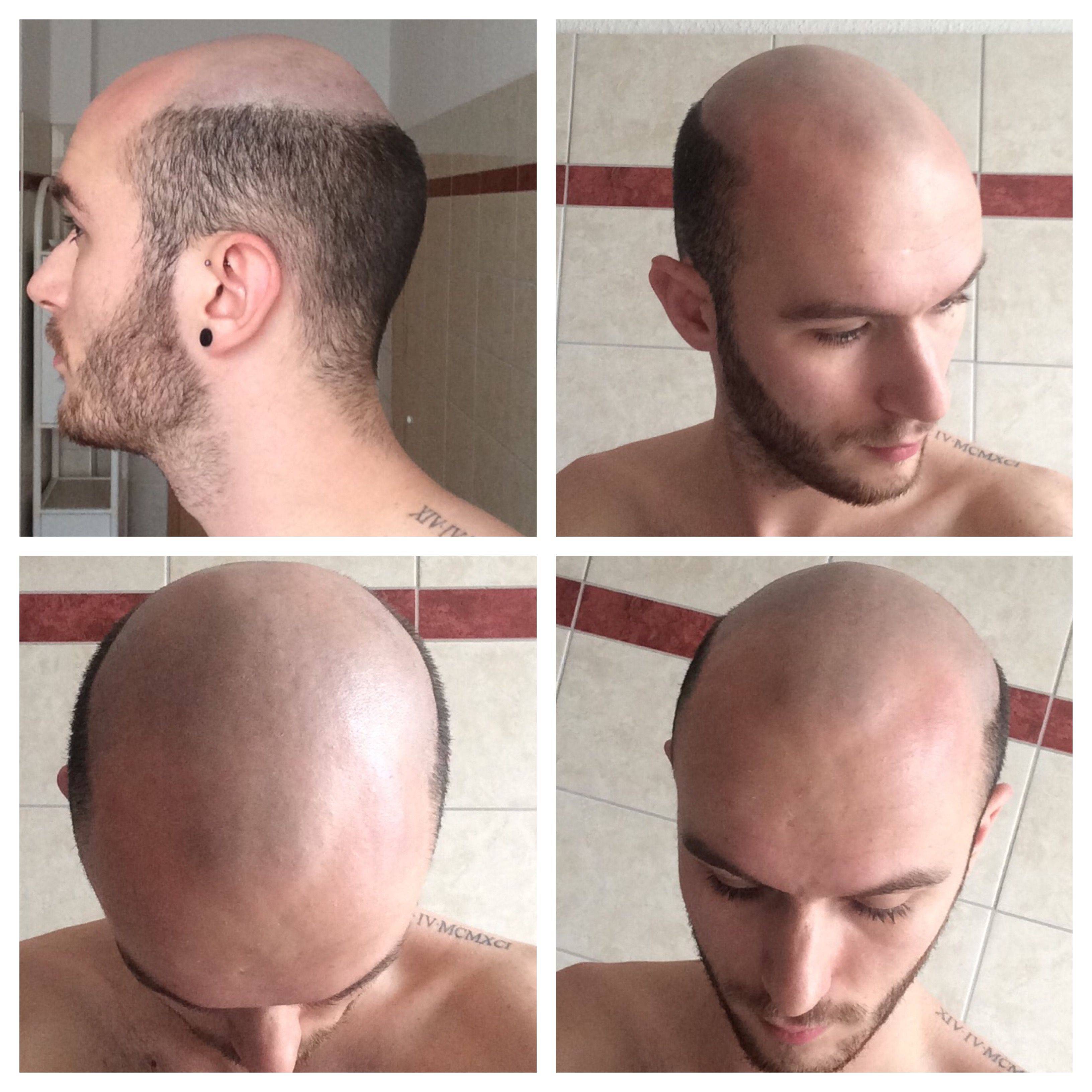 Почему мужчины бреют голову?