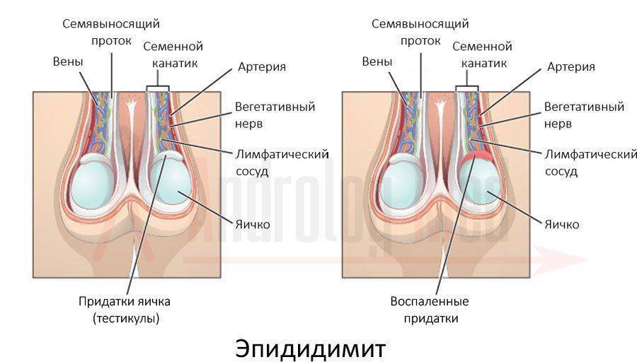 Болезнь половых органов сперма с кровью thumbnail