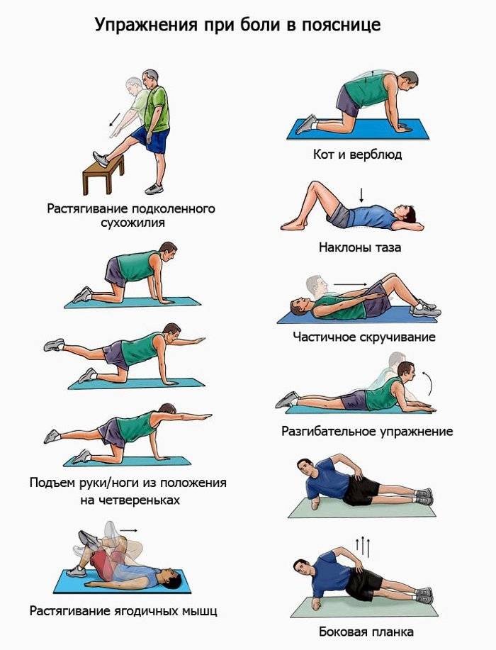 Топ-30 упражнений от болей в пояснице: на растяжку и на укрепление мышц