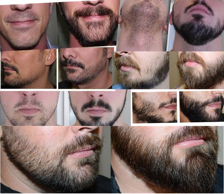 Сантиметры имеют значение: стадии роста бороды