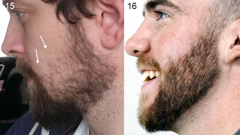 Как отрастить бороду в домашних условиях? как быстро растет борода?