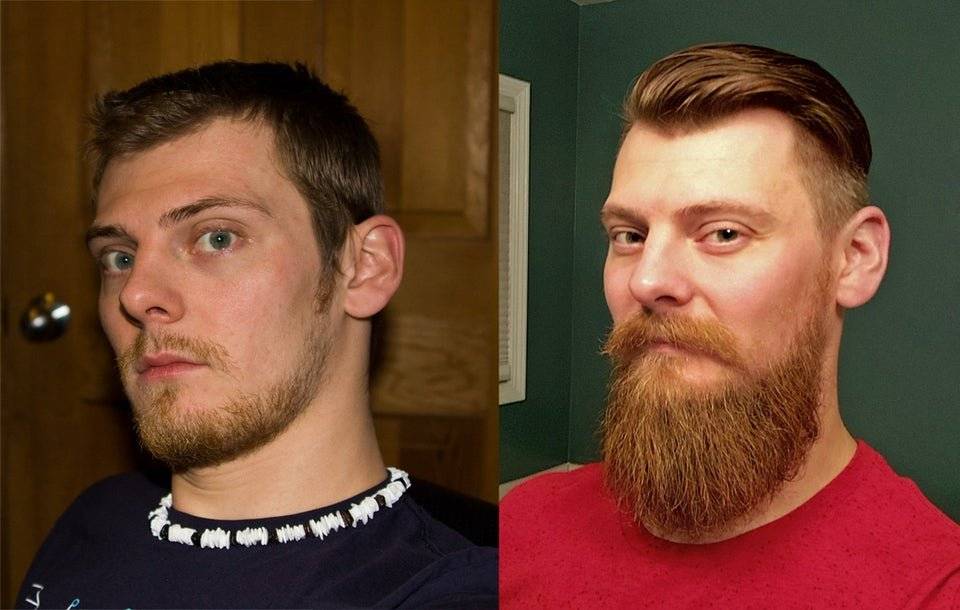 Сколько по времени и как растет борода у мужчин?