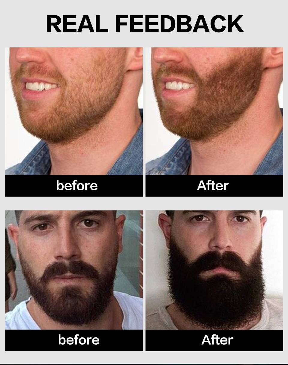 Как отрастить бороду: советы и рекомендации