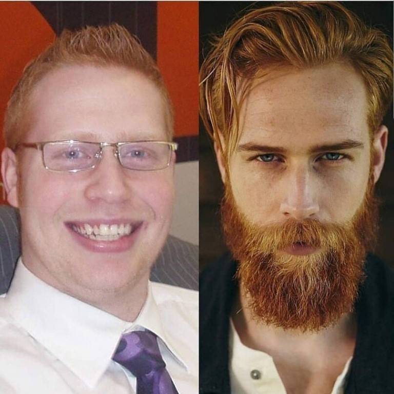 Как отрастить бороду?