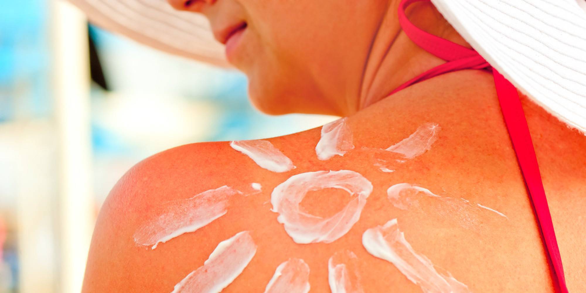 13 мифов о солнечных ожогах, которые вредят вашей коже