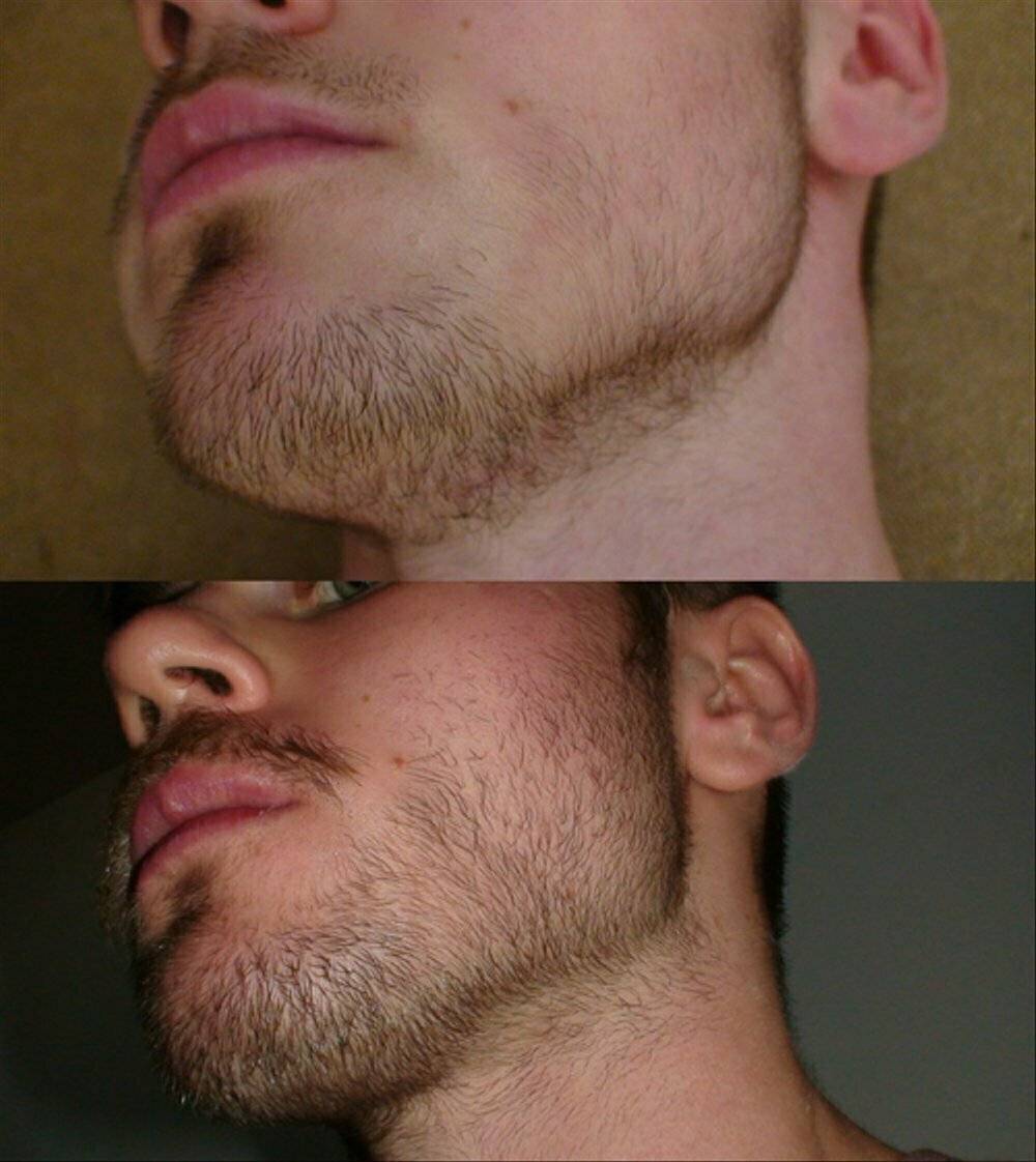Как отрастить бороду: пошаговая инструкция
