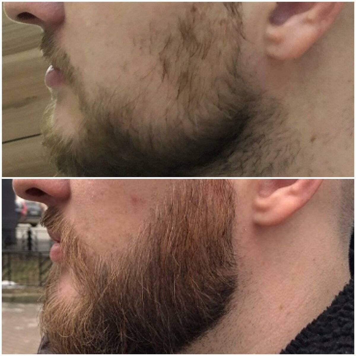 Как в первый раз отрастить красивую и длинную бороду